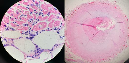 Weefsel onder de microscoop