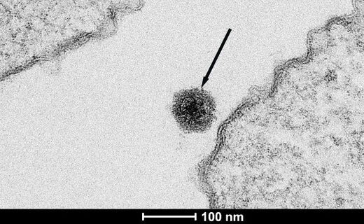 Elektronenmicroscopische afbeelding van het Yaravirus