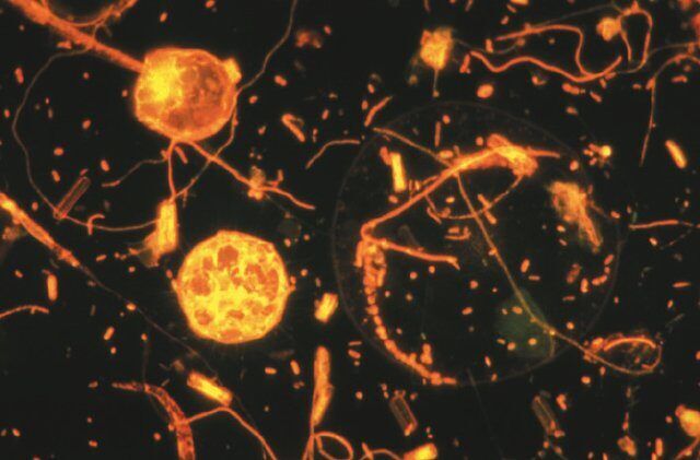 Microscopische foto van psychrofiele (koudeminnende) bacteriën.