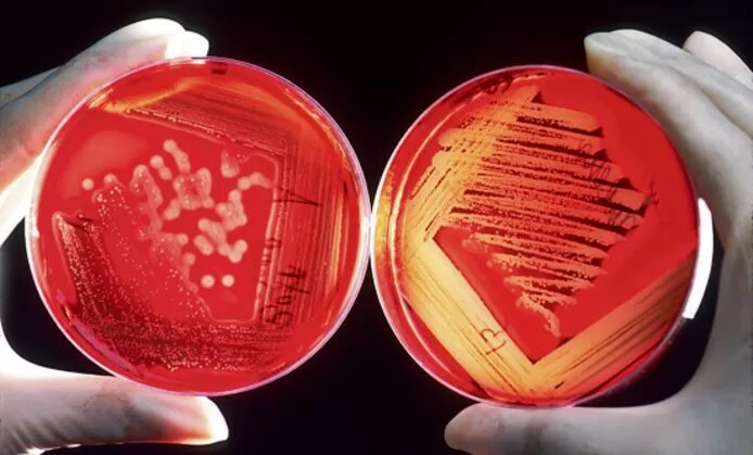 A streptokokken vleesetende bacteriën
